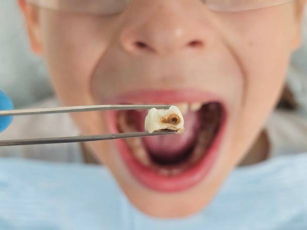 Best Emergency Dental Care for Sports Injuries in Daniels Farm, CT